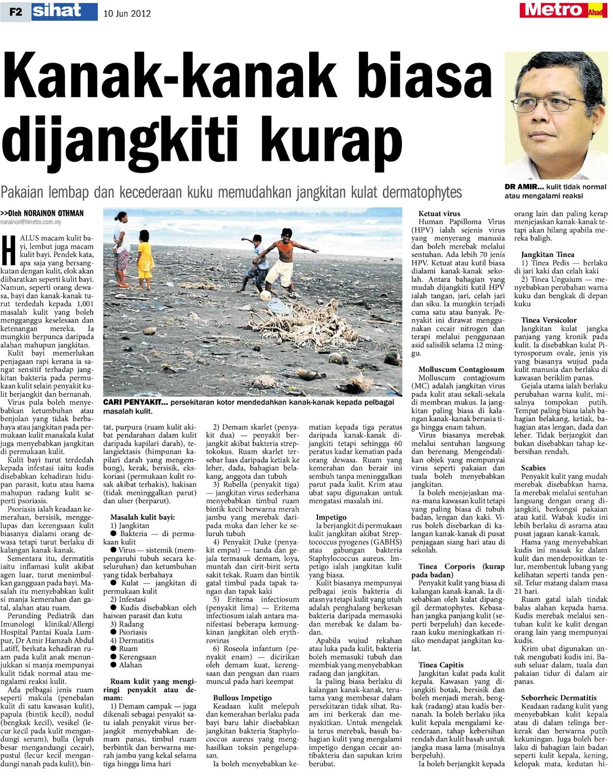 KanakKanak Mudah Dijangkiti Kurap  SenangEja.com