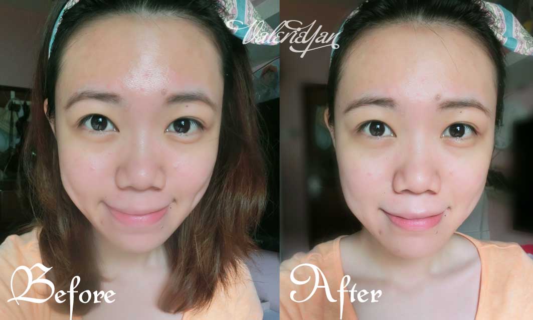 Everything About Life Ugb Aqua Cream Peeling Gel And Lycoz Bio Cellulose Mask From Korea Review