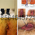 Obat Wasir Herbal AMBECLEAR Buatan Indonesia thumbnail