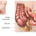 Acute Appendicitis Causes , Diagnosis , complications and treatment Acute Appendicitis Causes , Diagnosis , complications and treatment