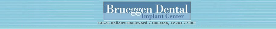houston all-on-4 dental implants houston all-on-4 dental implants