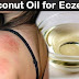 How To Get Rid Of Eczema With Coconut - Home Remedies