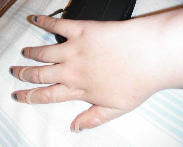 Amazin Arty Antics Random Swollen Hand Pics