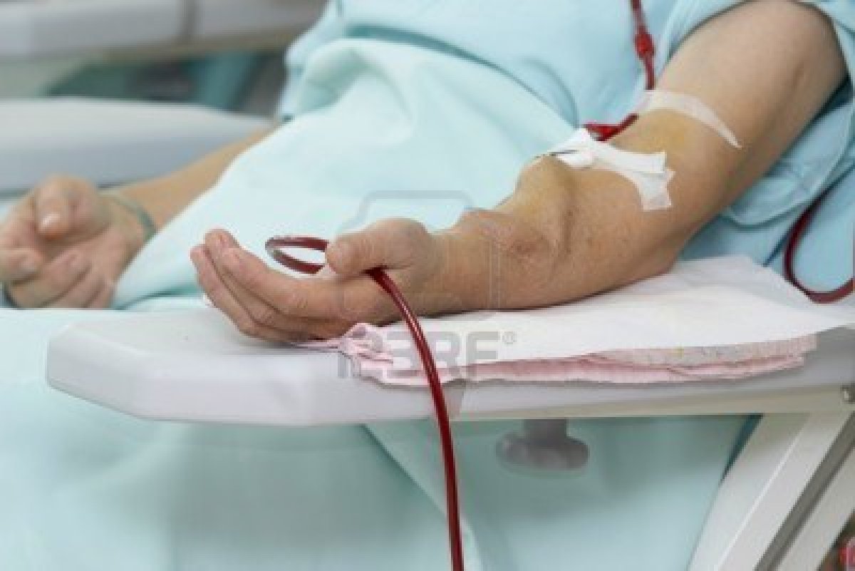 Dialysis Products Cause Deaths