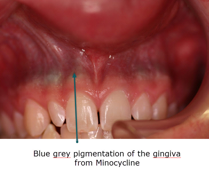 Dermatology For Dentists and Dental Students Oral Medicine for Dental