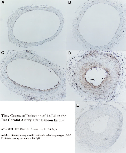 Balloon Induction Balloon Invitations Pictures