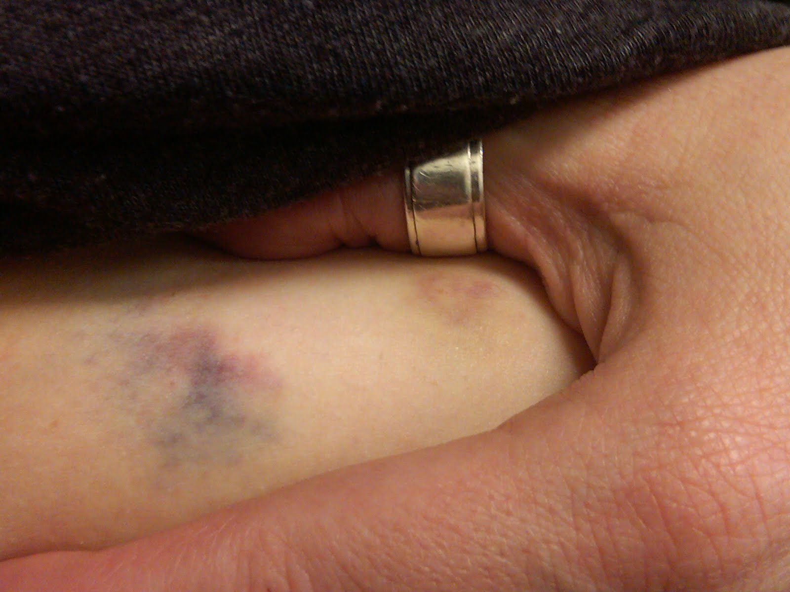 Doing round 2 only after 3 weeks hcg