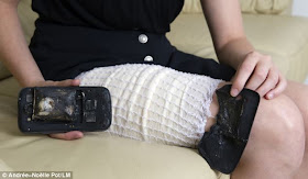 Samsung Phone Battery Catches Fire In Woman's Pocket