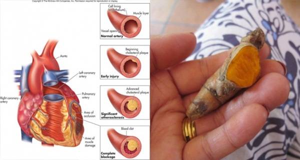 STUDY: A Pinch Of Turmeric As Effective As An Hour Of Exercise Turmeric