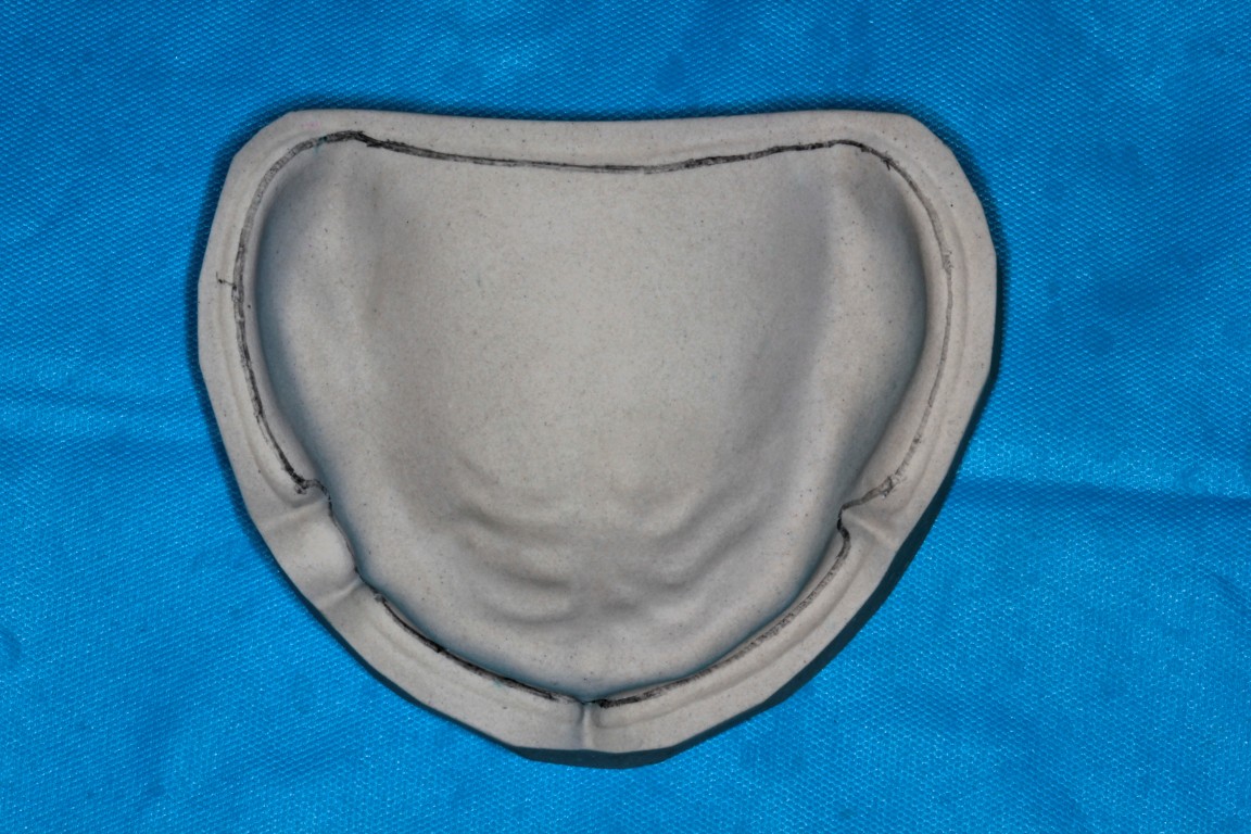 Step by step Guide for Understanding the Prosthodontics Spacer for