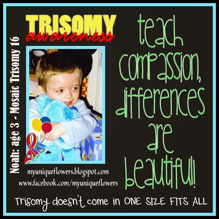 My Unique Flowers Noah & Mosaic Trisomy 16