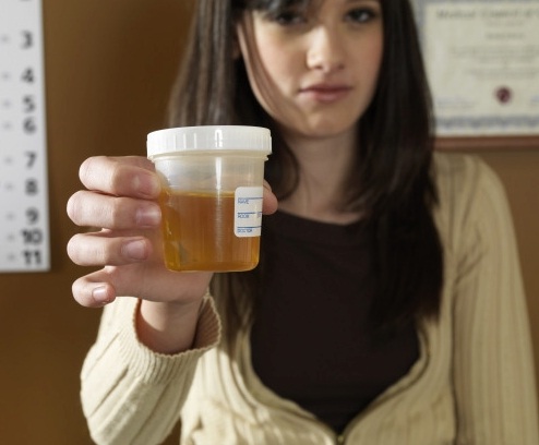 Urine Therapy And Miracle Cures Urine Test