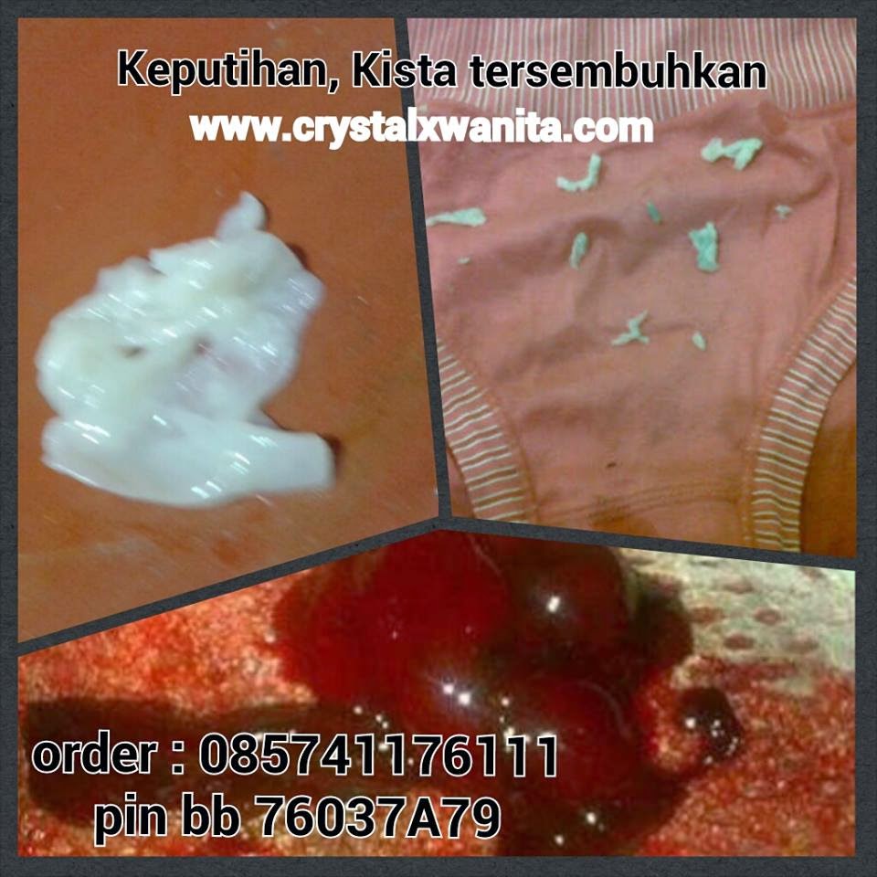 Efek Pemakaian Crystal X Efek Pemakaian Crystal X