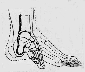 Foot binding beauty and torture essay 06 image