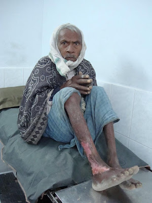 Jagadguru Kripalu Charitable Hospital Success Story