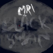 Mri :: Black Swan