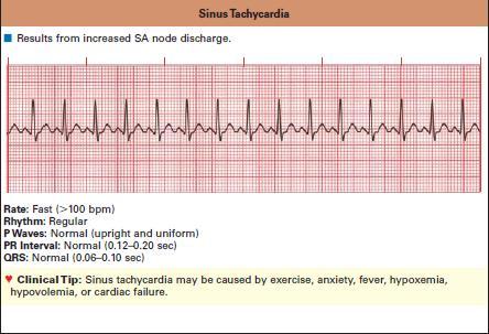 The normal heart rate in the average adult ranges from 60?100 beats/min. The normal heart rate in the average adult ranges from 60?100 beats/min.