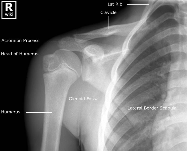 ON RADIOLOGY Radiographic anatomy of Paediatric Shoulder
