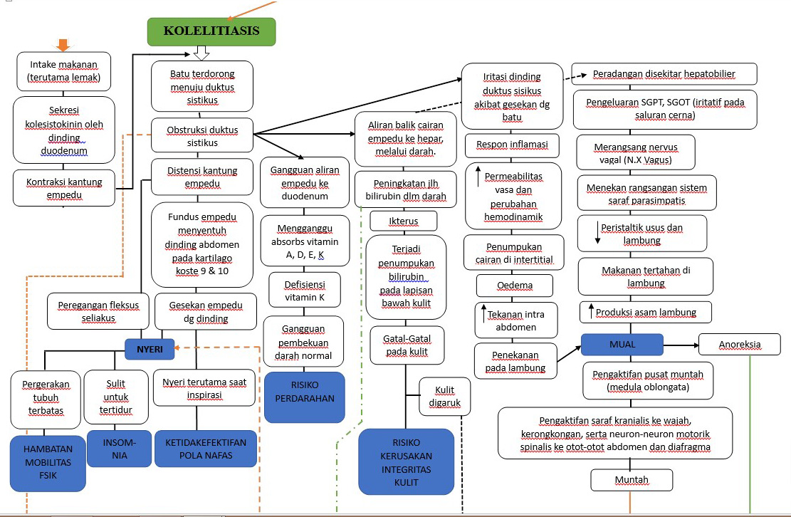 Alfian�s Free Zone MAKALAH KMB I KOLELITIASIS (Batu