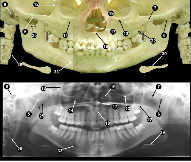 Tecnicos Radiologos: Ortopantomografia (Radiografia dental panorámica)
