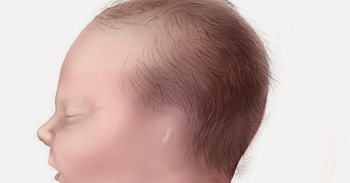 Psychology of Medicine Anotia