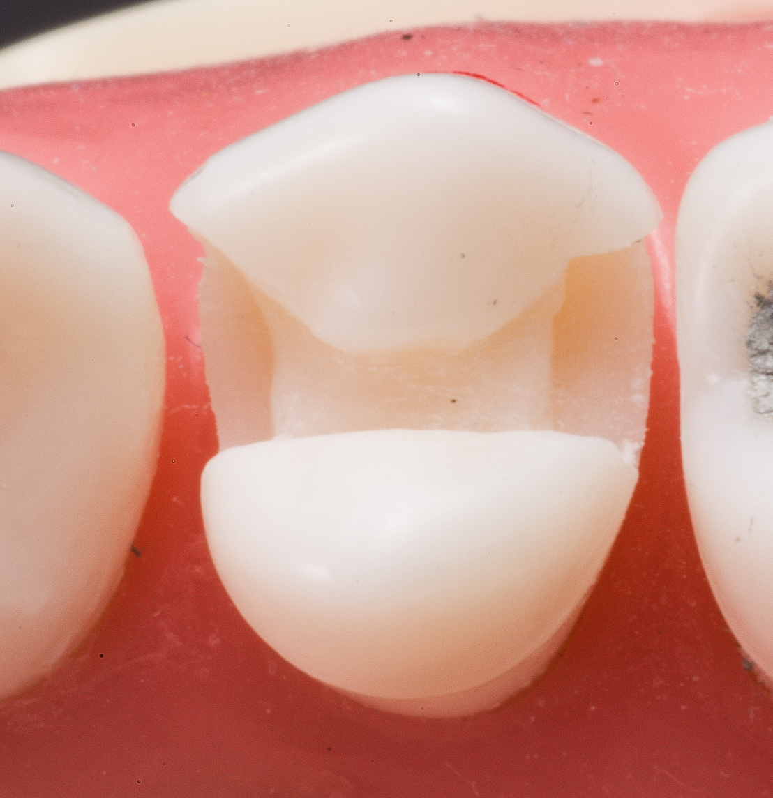 Operative EPortfolio Balandran, Steven