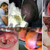 Apakah ciprofloxacin Dapat Menyembuhkan Kencing Nanah thumbnail