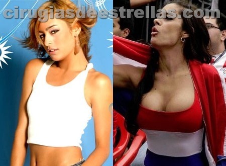 Antes y Después del bisturí,impresionante !! Antes y Después del bisturí,impresionante !!