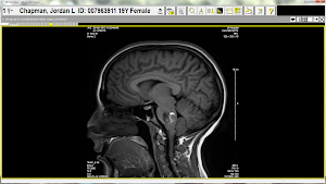 MRI 4/26/12