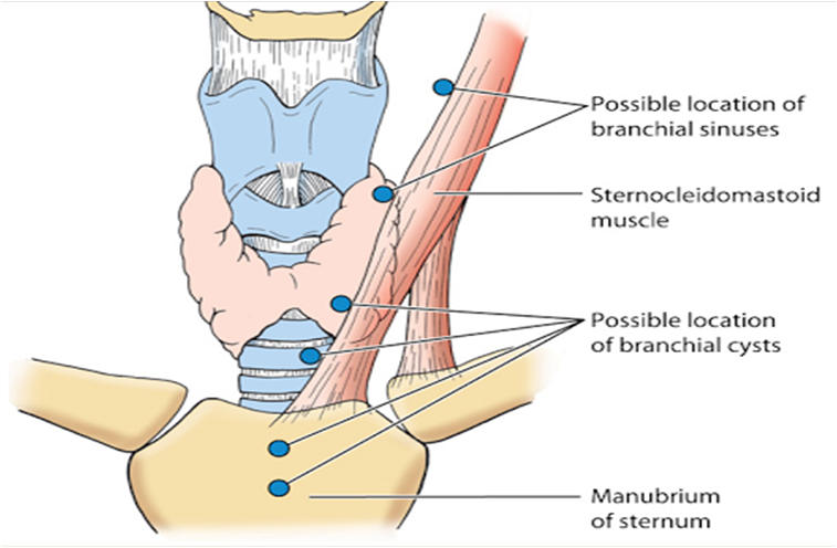 Branchial cysts in adults