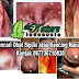 Obat Kencing Nanah Manjur