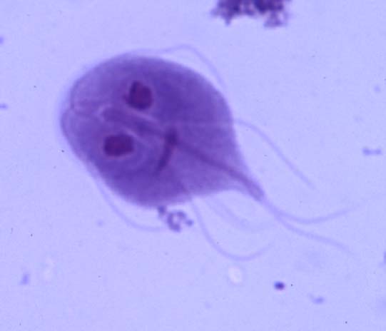 http://paleovegan.blogspot.ca/2013/01/paleo-parasite-profile-1-giardia-lamblia.html