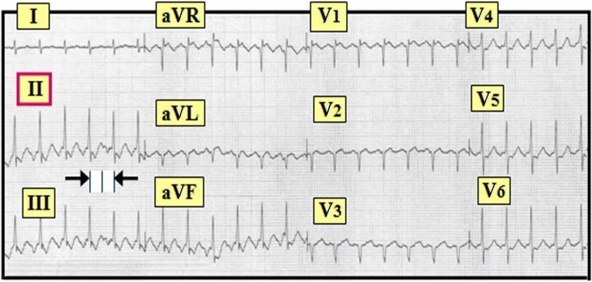Reentry Svt