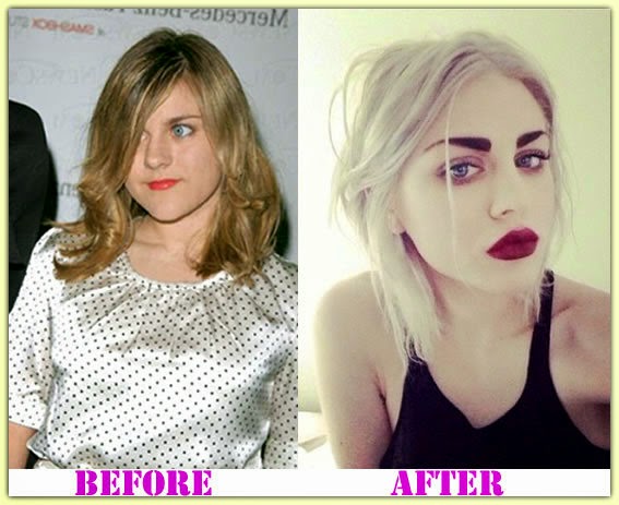 frances bean cobain plastic surgery