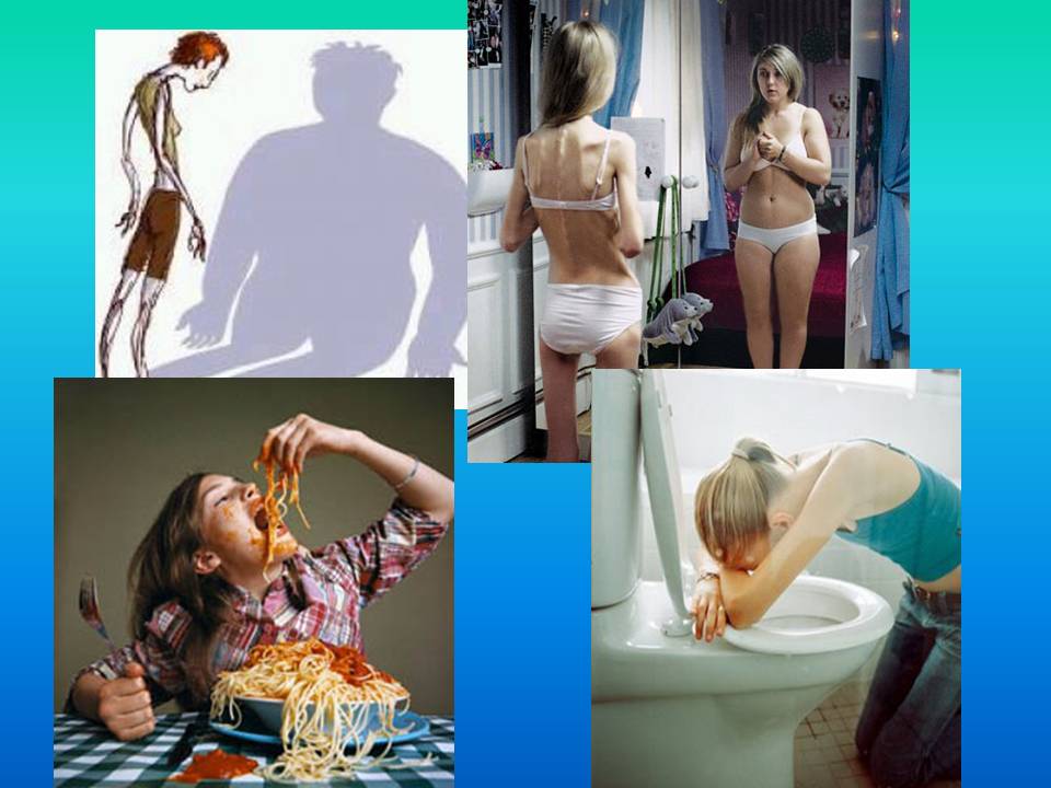 an overview of the eating problem anorexia nervosa Topic overview what is anorexia nervosa what causes anorexia eating disorders are recognizing or wanting to talk about having a problem with eating or. an overview of the eating problem anorexia nervosa Topic overview what is anorexia nervosa what causes anorexia eating disorders are recognizing or wanting to talk about having a problem with eating or.