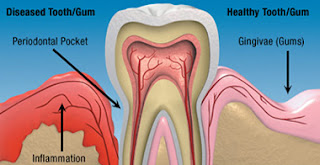 Dentists Silver Spring