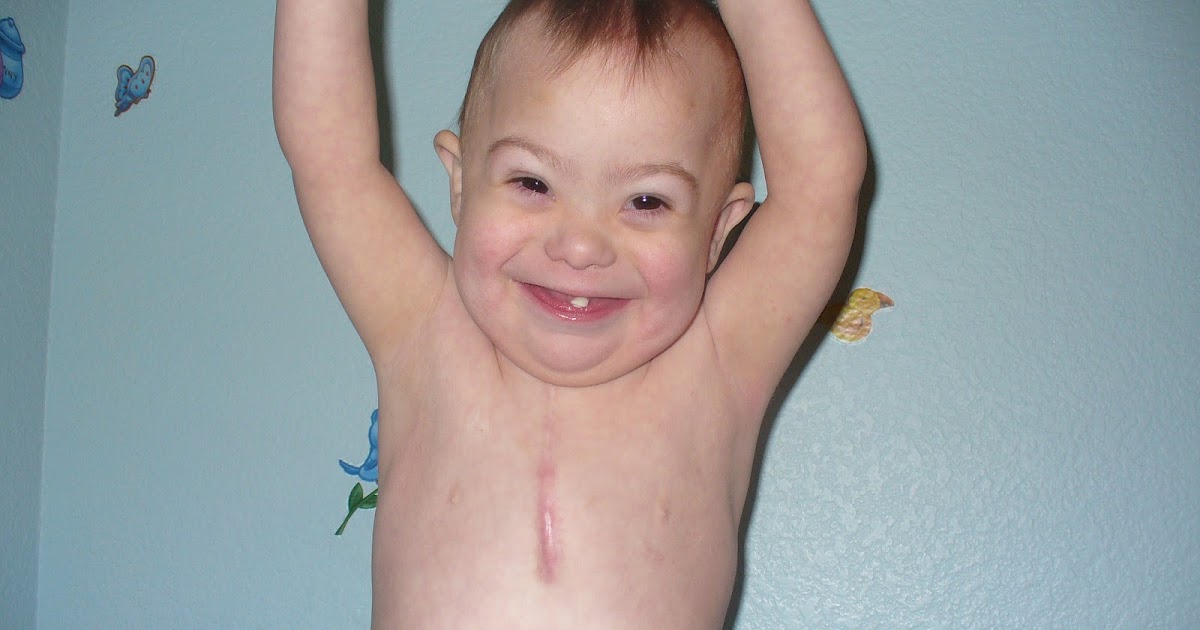 Team David Feeding Tube Awareness Week Begins