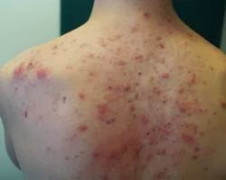 La crema para la depuración de la persona por las manos