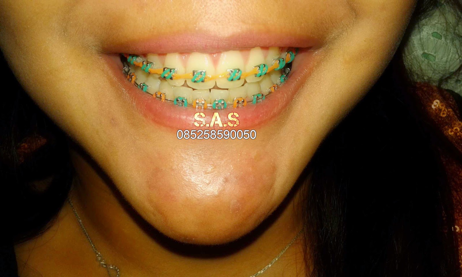 S.A.S AHLI GIGI KOTA PATI, Jateng &amp; KOTA JEMBER, Jatim