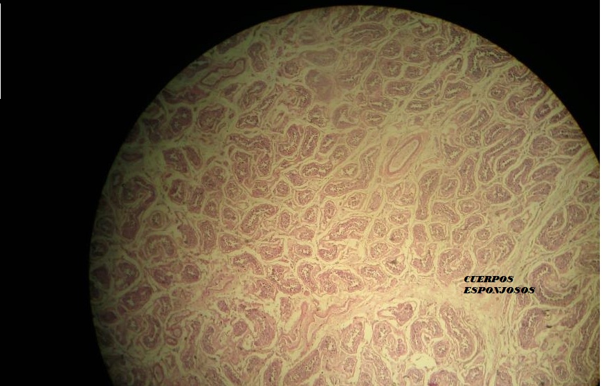 amoxicillin dose otitis media amoxicillin dose otitis media