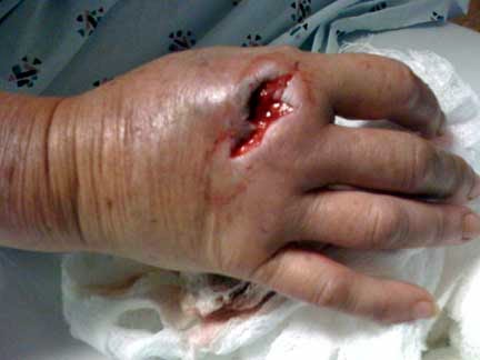 Dogs Eye Bleeding Cat Scratch Dogs Eye Bleeding Cat Scratch