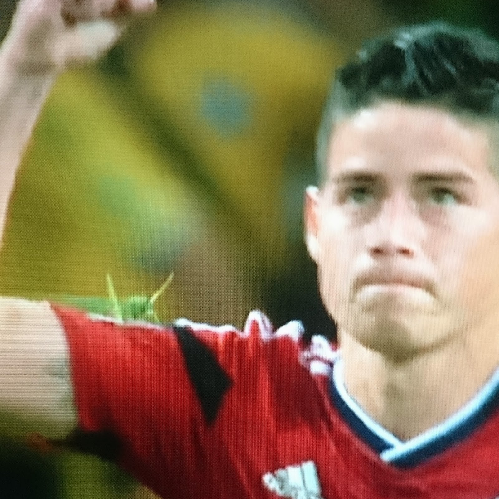 James Rodriguez locust arm James Rodriguez locust arm