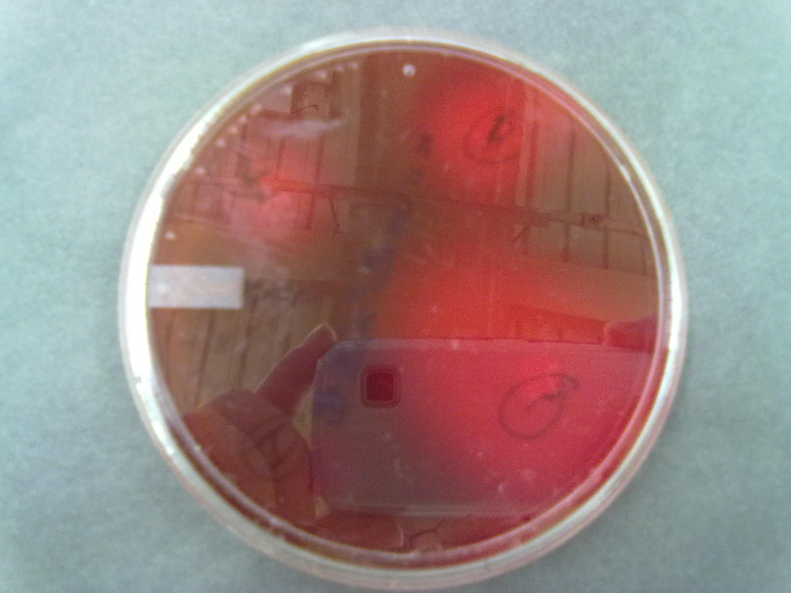 Staphylococcus Aureus Does What On Mannitol Salt Agar