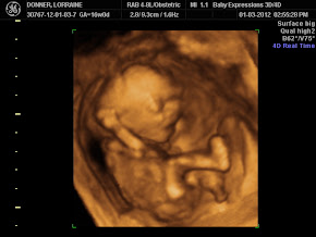 3d ultrasound.