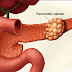 FDA approves new treatment for advanced pancreatic cancer