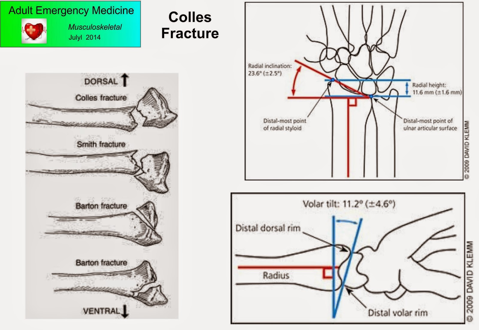 Musculoskeletal Emergency Medicine