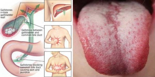 You Need To Flush Toxins Out Of Your Body If You See These 9 Warning Signs You Need To Flush Toxins Out Of Your Body If You See These 9 Warning Signs