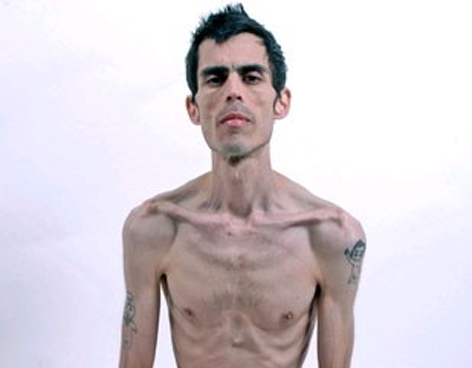 dieta vegetariana para perder peso rapido Por definir dieta vegetariana para perder peso rapido ara quitar