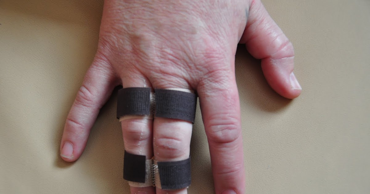 Haken…..Crochet…..: Joepie niet gebroken alleen flink gekneusd.