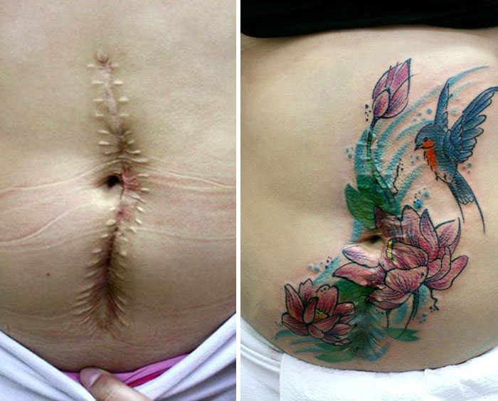 Tattoo Artist Offers Free Work For Survivors Of Domestic Violence - “She told me that she was at a nightclub, and when she turned down a man who approached her, he stabbed her with an switchblade” Tattoo Artist Offers Free Work For Survivors Of Domestic Violence - “She told me that she was at a nightclub, and when she turned down a man who approached her, he stabbed her with an switchblade”